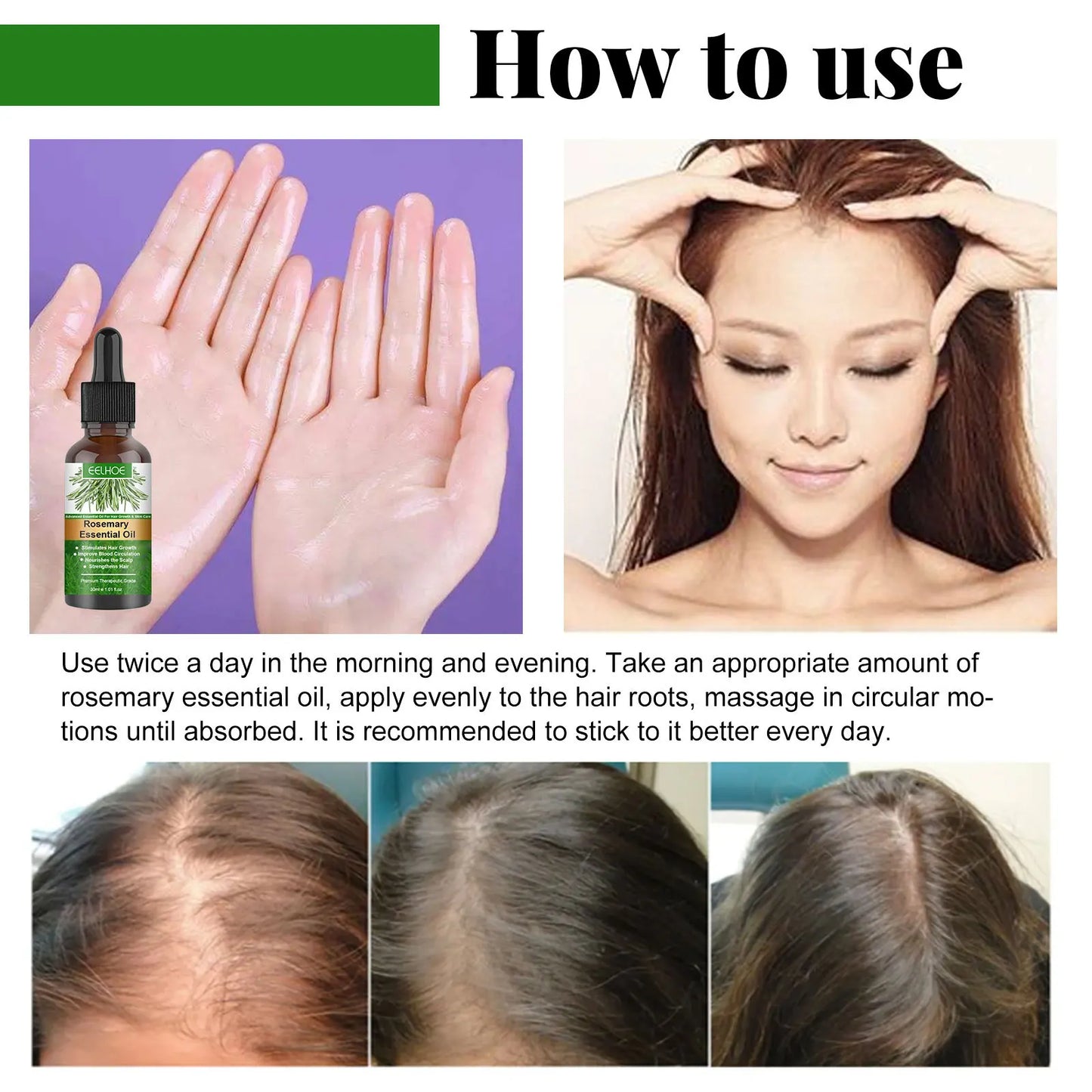 EELHOE Rosemary Essential Oil Nourishes Repairs Improves Frizz Prevents Hair Loss Eliminates Itching Thinning Damaged Hair Care